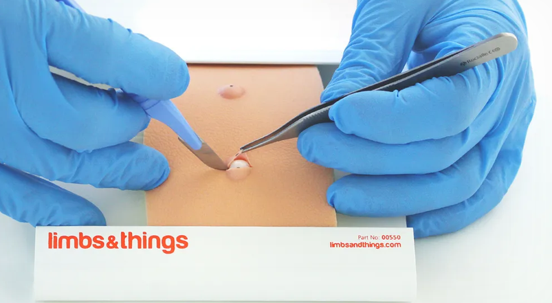 Sebaceous Cyst Pad ( 00071)