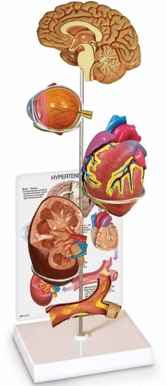 Hypertension Model Set (SB40233)