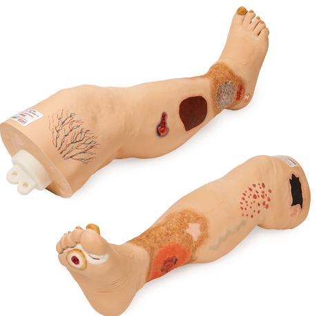 \\\"Vinnie\\\" Venous Insufficiency Leg (SB50123)